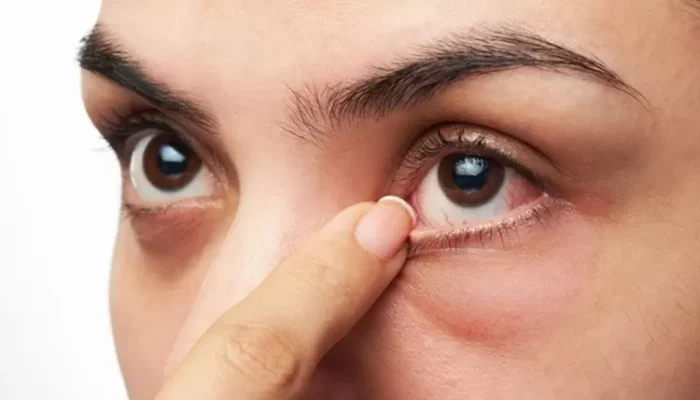 Saat Mata Tak Lagi Bisa Berpaling